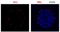 TRF1 | Telomeric repeat-binding factor 1 in the group Antibodies Human Cell Biology / Epigenetics/DNA Methylation at Agrisera AB (Antibodies for research) (AS16 3961)